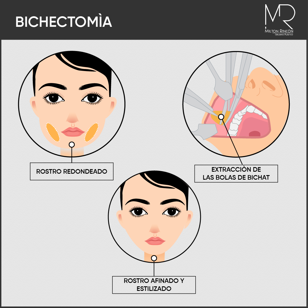 Evolución de abdominoplastia